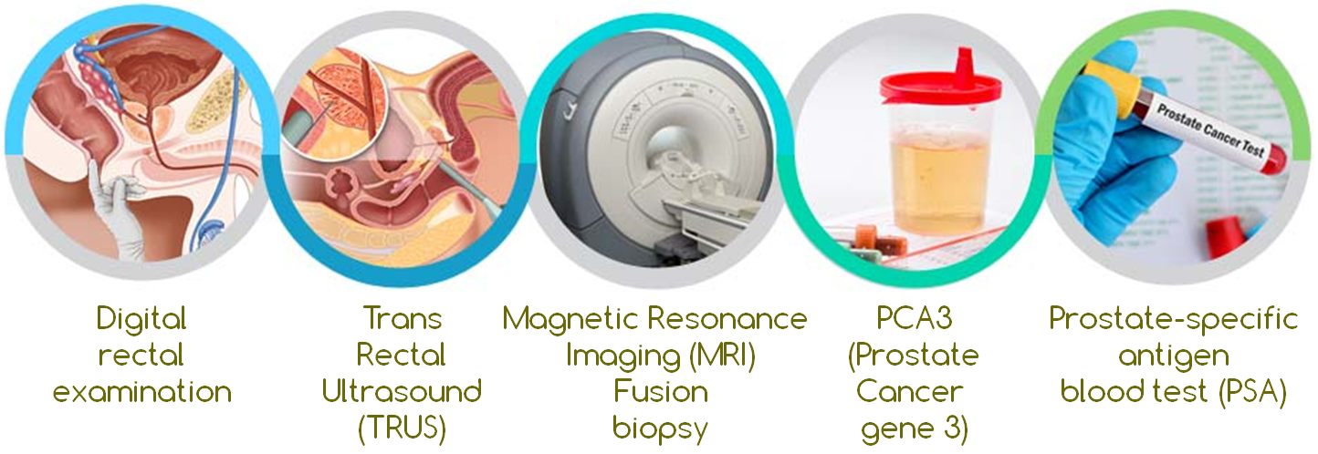Рак простаты москва. Ректальное исследование простаты при РПЖ. Cancer PSA Test. Prostate Cancer PSA Test. Diagnosis.